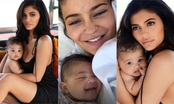Kylie Jenner desabafa sobre seus lábios e já revela o que Stormi herdará se quiser!