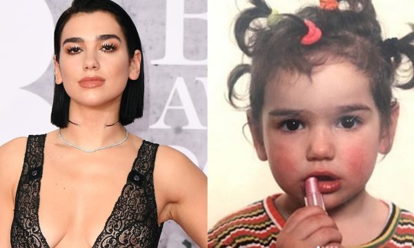 Dua Lipa responde acusações de que teria editado suas fotos de criança para aumentar os lábios: “Vocês são loucos”