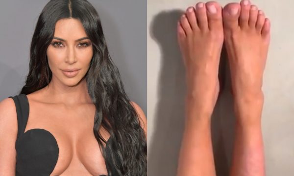 Kim Kardashian conta segredo para cobrir doença de pele e mostra um impressionante “antes e depois”
