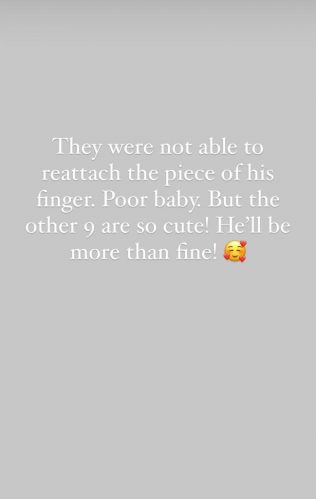 Médicos não conseguiram reconstruir o dedo de Kingston. (Foto: Reprodução/Instagram)