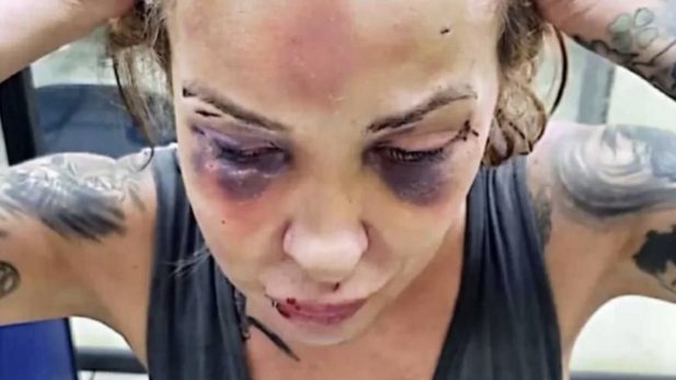 Vítima teve o rosto desfigurado. (Foto: Polícia Civil do Rio de Janeiro/Divulgação)