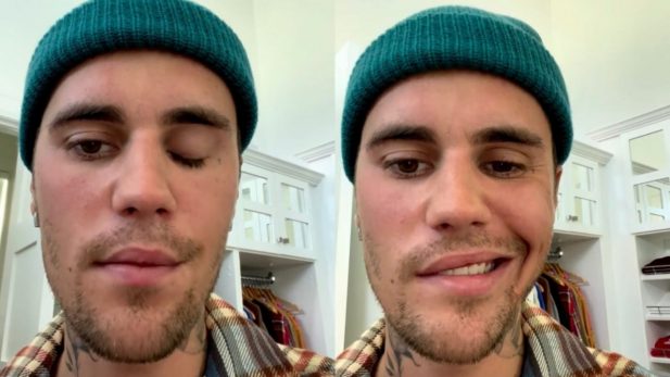 Justin Bieber Sindrome