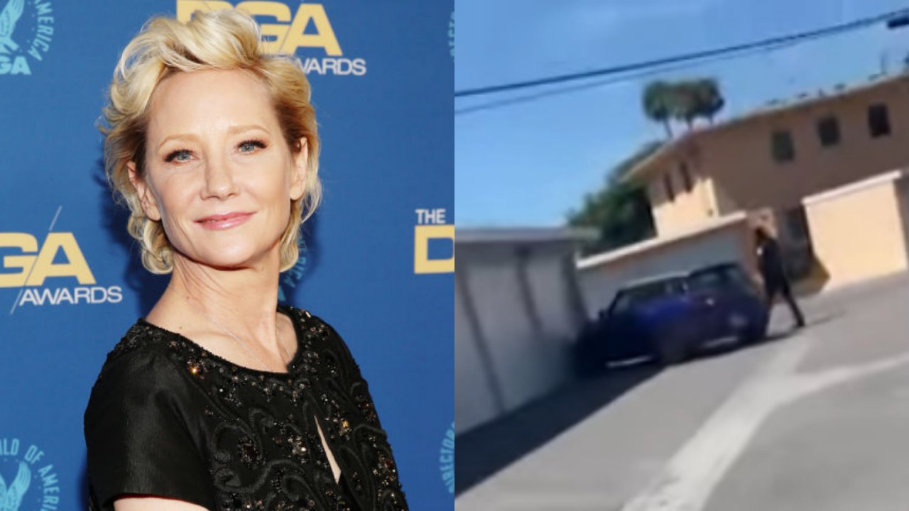 Atriz Anne Heche sofre acidente de carro e está intubada em hospital, após veículo pegar fogo