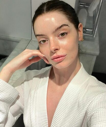 A modelo passou por um tremendo susto (Foto: Reprodução/Instagram)