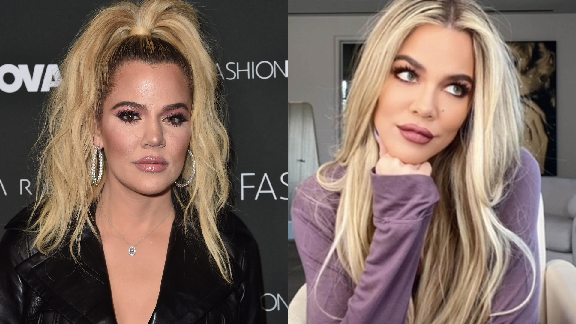 Khloé Kardashian revela cirurgia após descobrir tumor raro no rosto, e mostra fotos