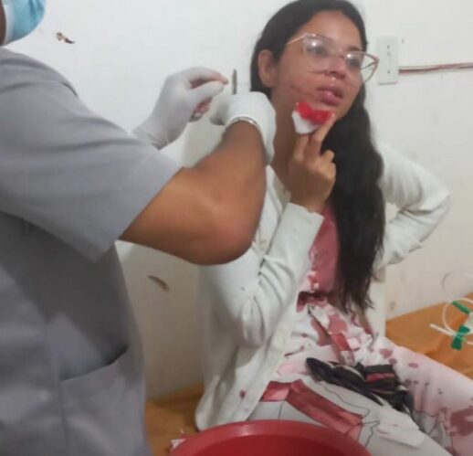 Stefani Firmo foi atendida em um hospital depois de ter seu rosto cortado (Foto: Reprodução/Instagram)