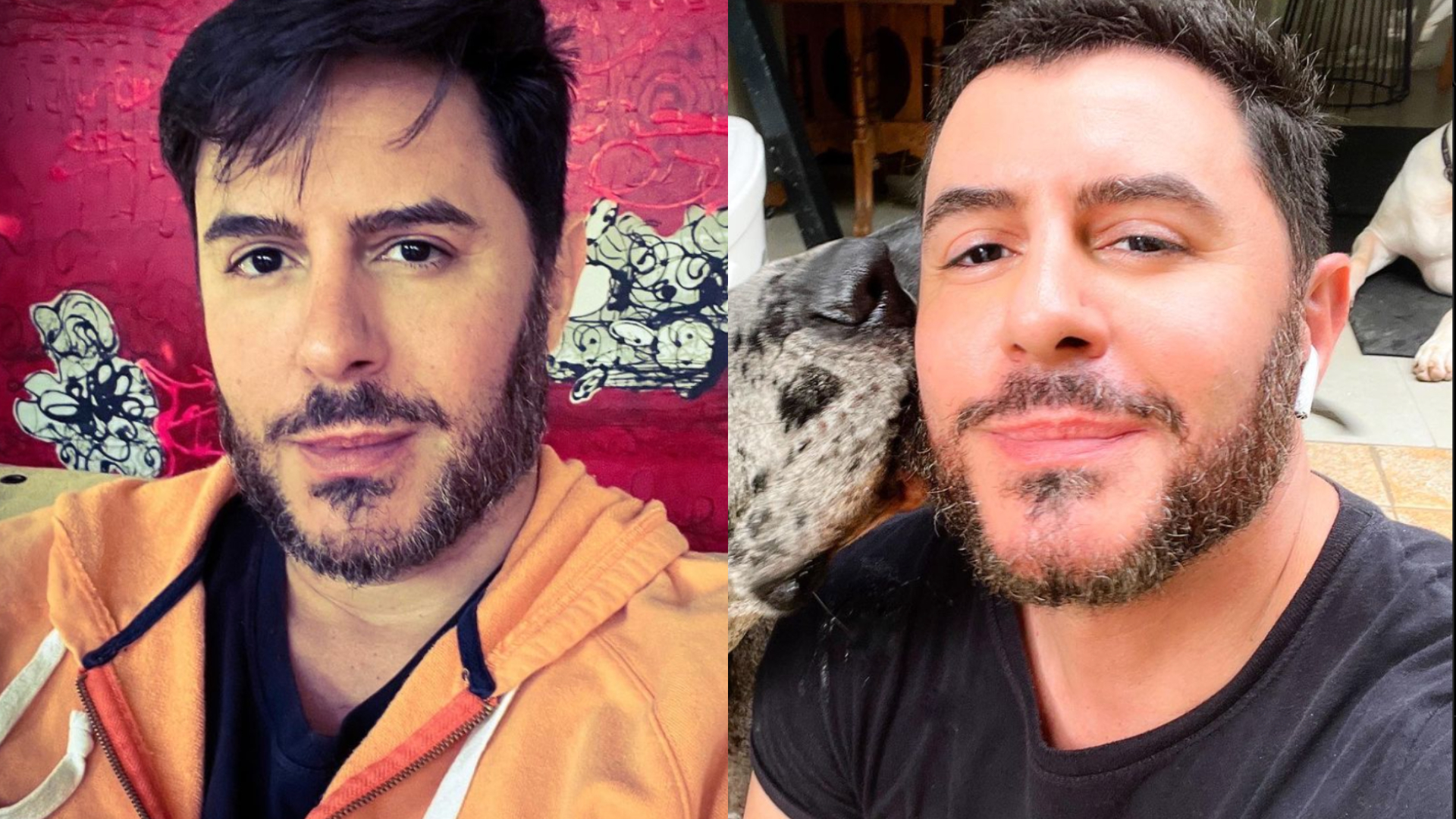 Confira harmonização facial de famosos que deram o que falar na