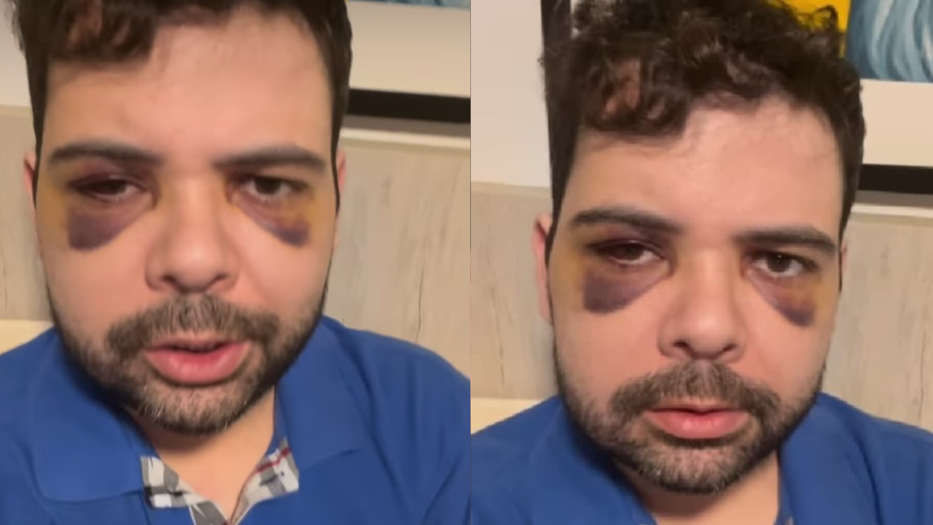 Polícia desmente versão de Gustavo Mendes, que reage nas redes; vídeo mostra ataque sofrido – assista