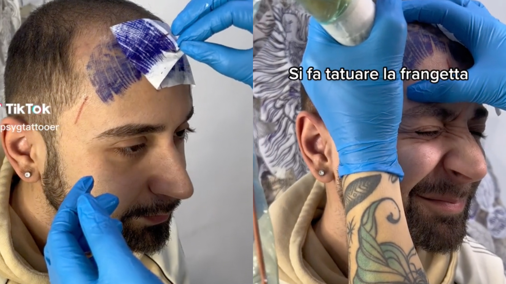 Homem careca chora após tatuar franja na testa, viraliza na web, e tatuadora revela desfecho; assista