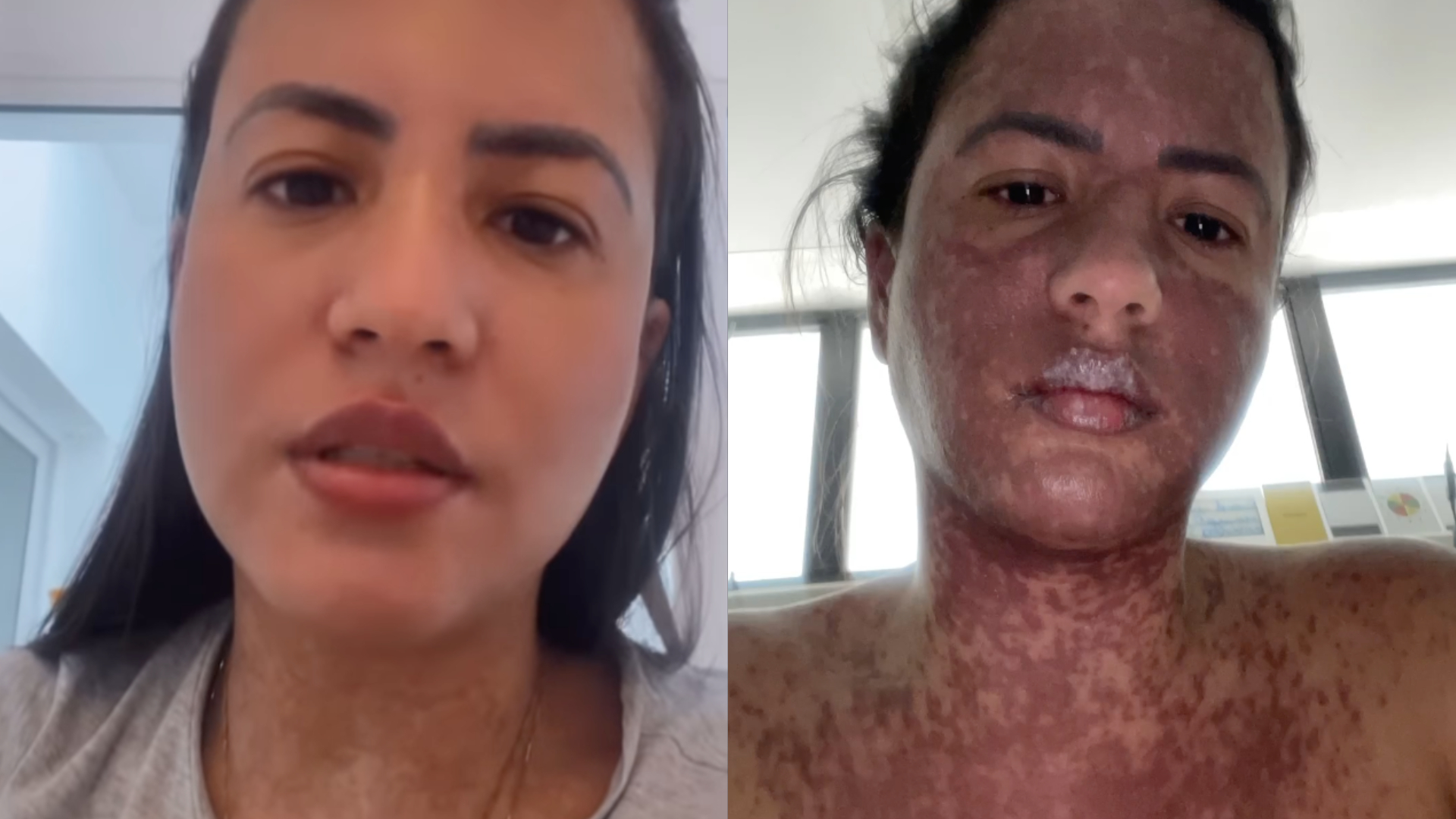 Esposa de Frank Aguiar detalha internação na UTI por doença rara: “Queima o corpo”; assista