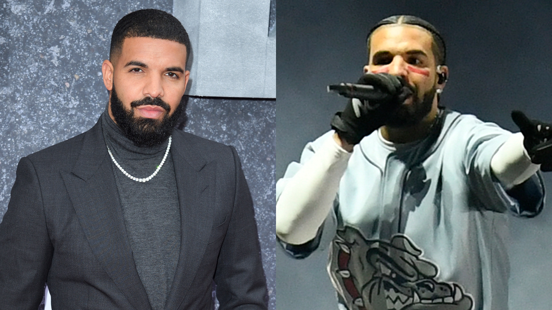 Drake anuncia pausa na carreira e revela problema de saúde