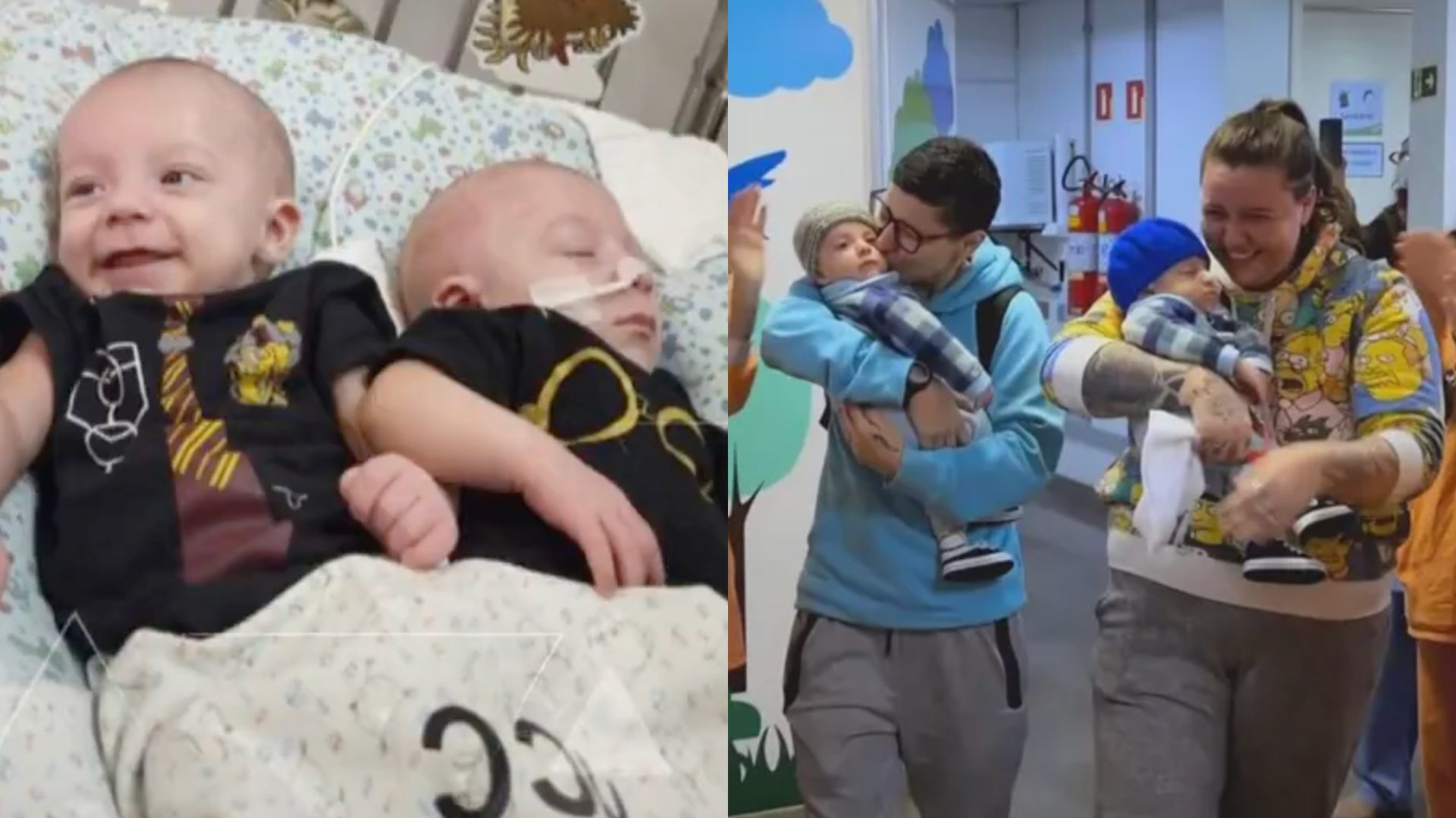 Gêmeos siameses são abandonados em hospital em Porto Alegre, passam por cirurgia impressionante e desfecho emociona; assista