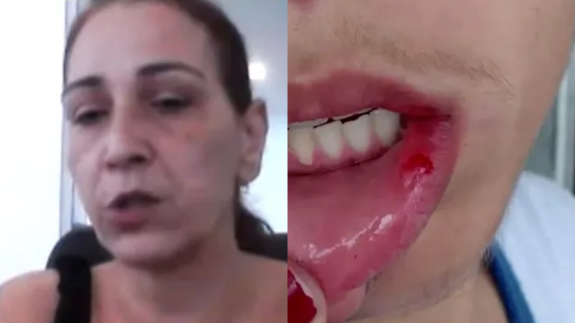 Mãe de adolescente espancado por colegas em SP revela como filho está após ataque e aponta medo: “Uma vingança”; assista