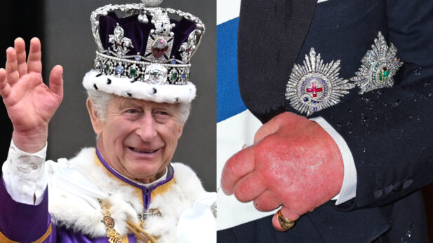 Rei Charles faz piada com seu apelido viral “dedos de salsicha” em novo documentário da BBC