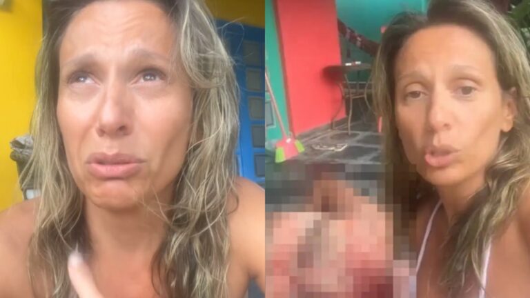 Luisa Mell ajuda rapaz que se acidentou com vidro em Ilhabela