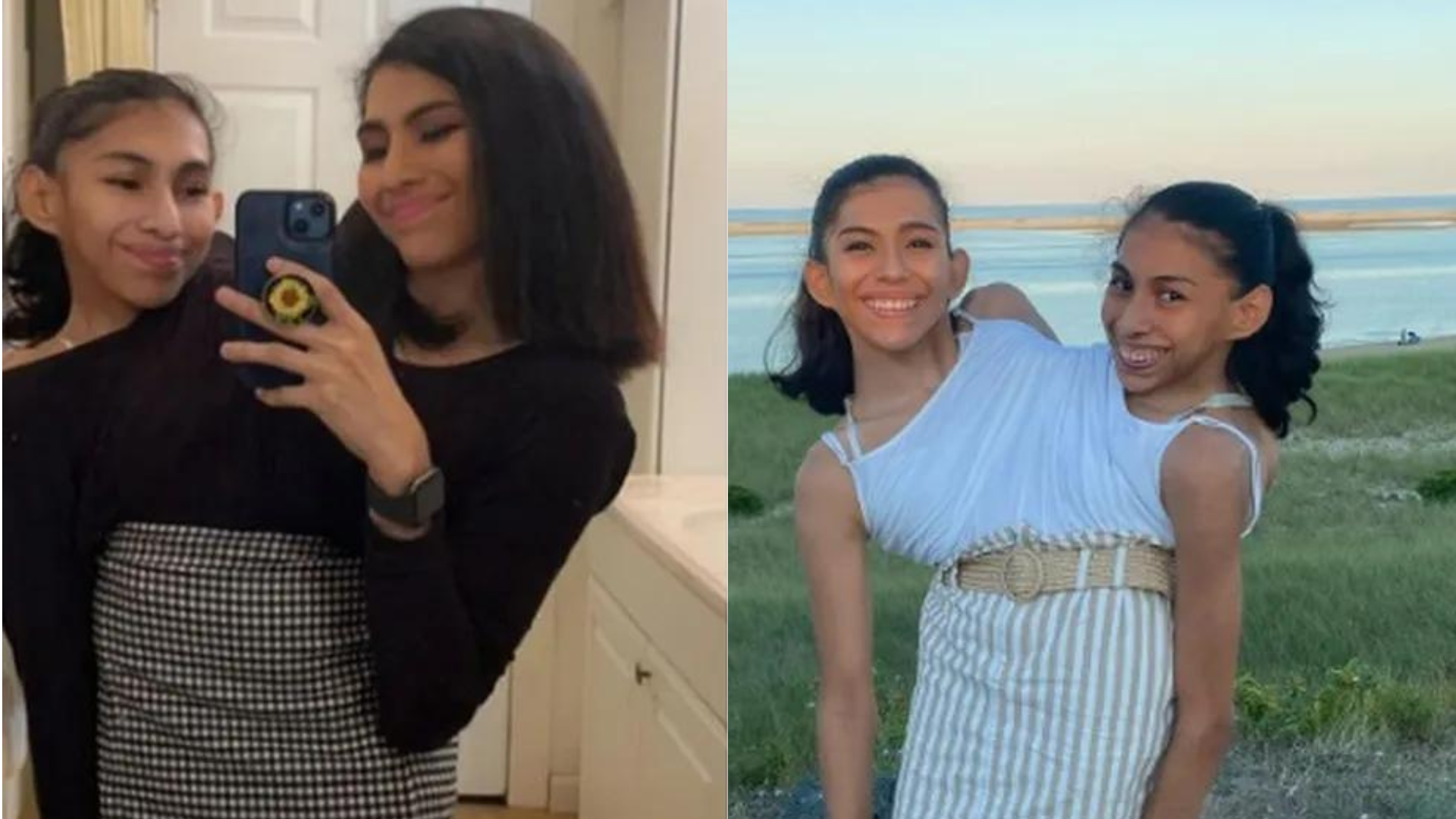 Gêmeas siamesas tiram dúvidas em vídeo viral e contam como se dá vida íntima: ‘Existem acordos’; assista