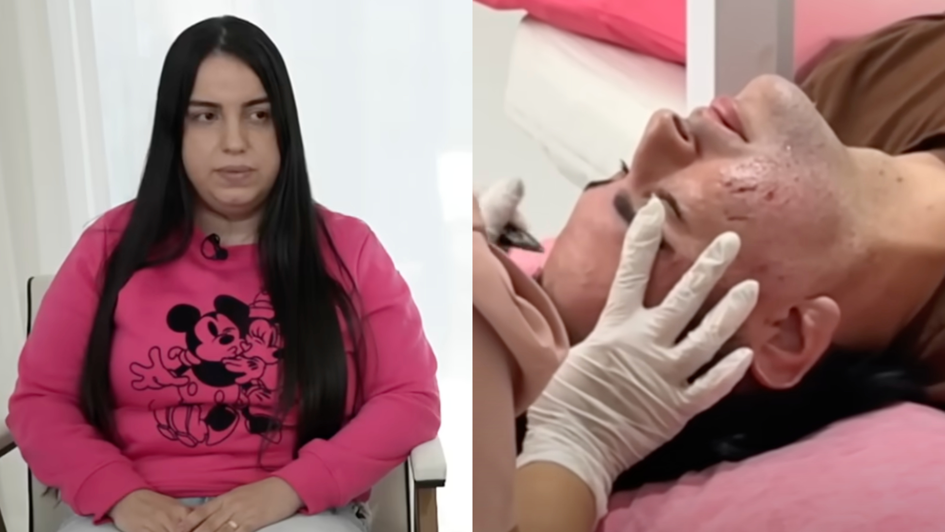 Peeling de fenol: Influenciadora vira ré por homicídio de paciente