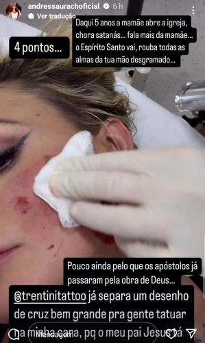 Andressa Urach leva 4 pontos no rosto e promete abrir igreja (Foto: Reprodução / Instagram)