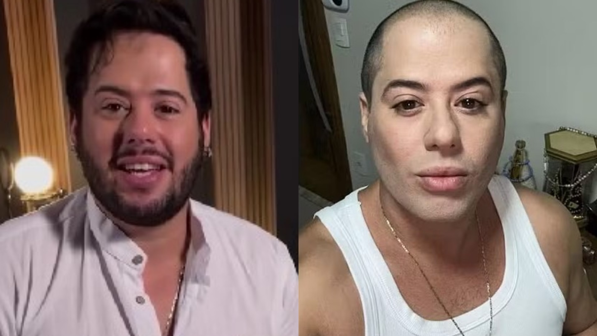 Hugo, dupla de Tiago, explica aparência em foto, nega harmonização facial e exibe verdadeiro visual; assista