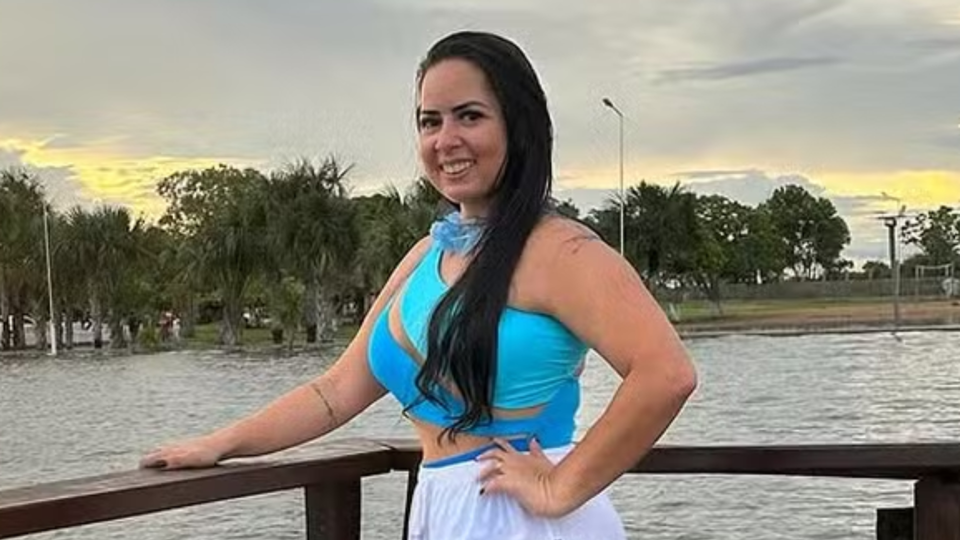 Brasileira de 34 anos morre após fazer cirurgia plástica na Venezuela