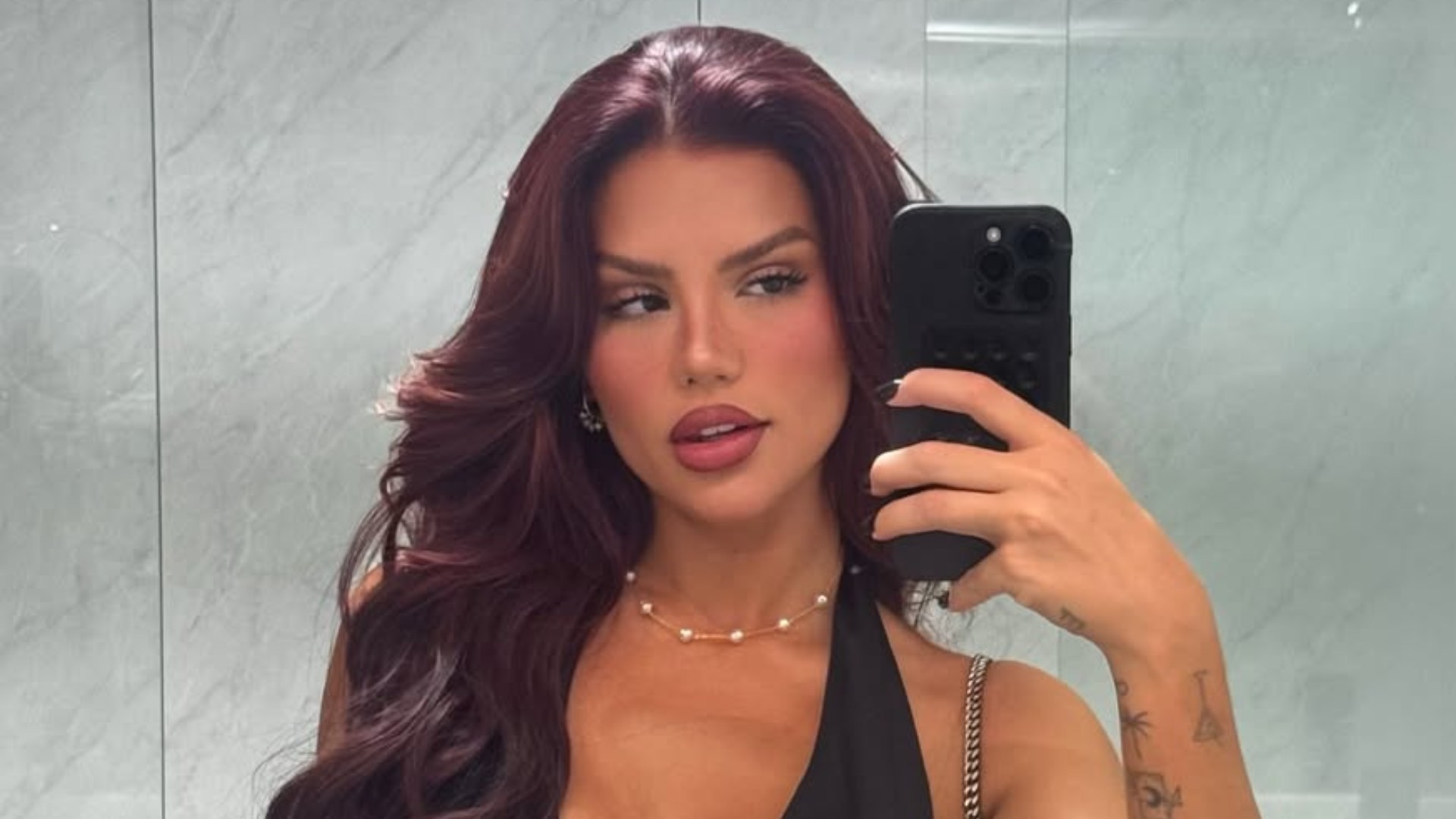 Vivi Wanderley passa por cirurgia após descobrir contratura da prótese de silicone