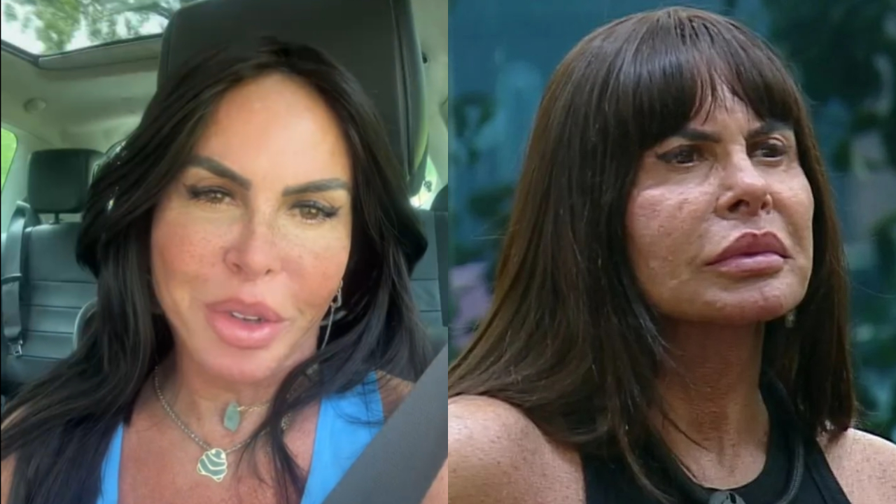 Gretchen faz nova harmonização facial e mostra rosto sem filtro: “Ficou fininho”; assista