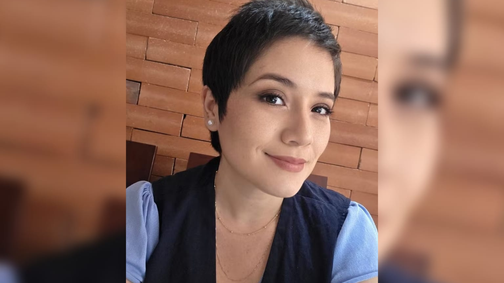 Colombiana se torna 1ª pessoa no mundo a fazer cirurgia inédita para depressão crônica; saiba como funciona