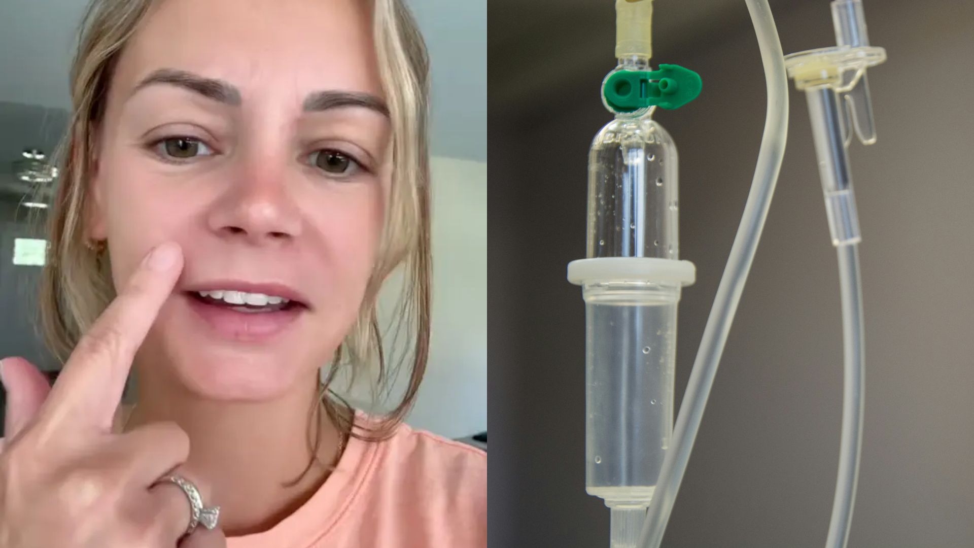 “Triângulo da morte”: Mulher viraliza ao contar que foi parar no hospital após estourar espinha em ponto específico do rosto, e faz alerta; assista