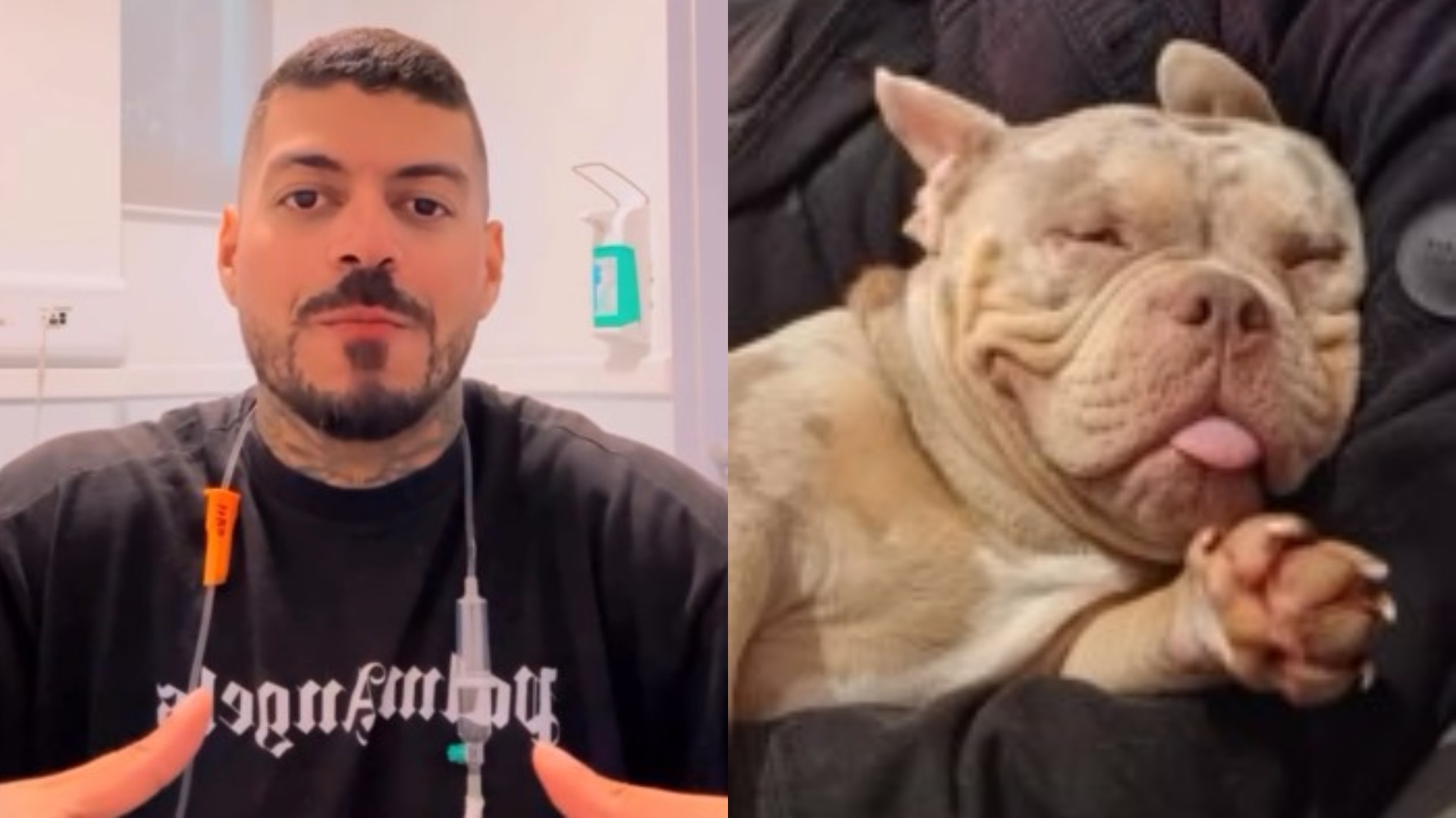 Influenciador acorda sem dedo do pé e descobre que cachorro comeu membro; vídeo impressiona Foto: Reprodução/Instagram